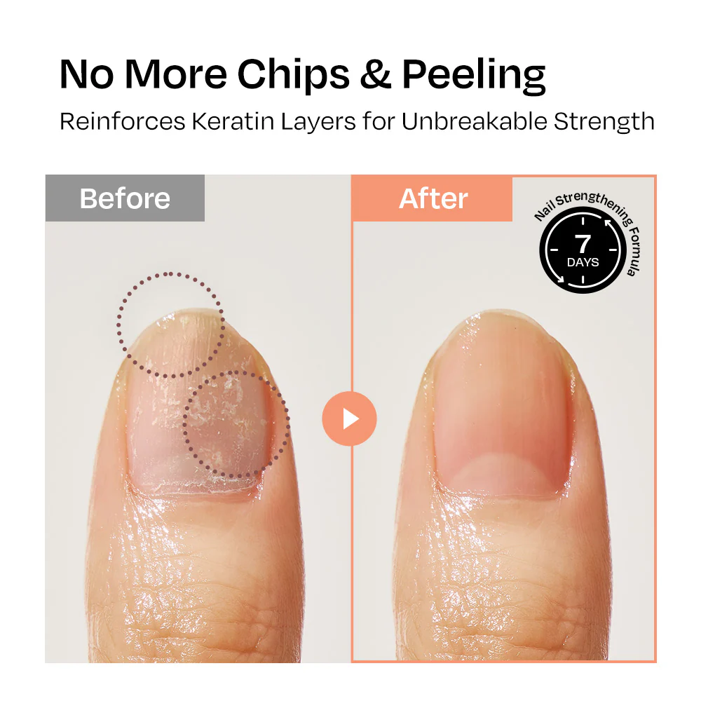 [Apricot] Nail Strengthener - Image 5