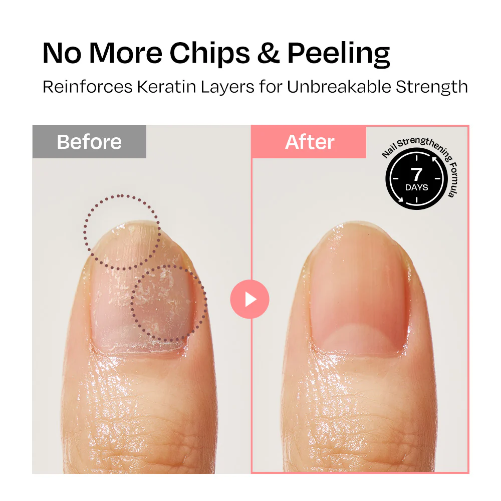 [Strawberry] Nail Strengthener - Image 5