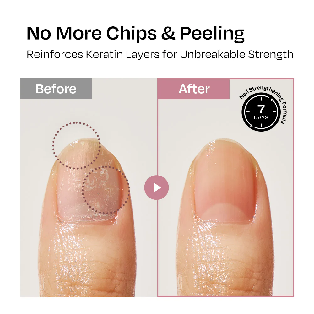 [Taro] Nail Strengthener - Image 5